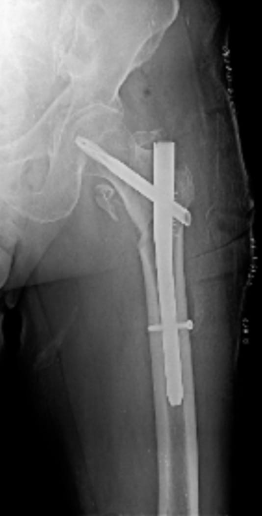 After surgery example