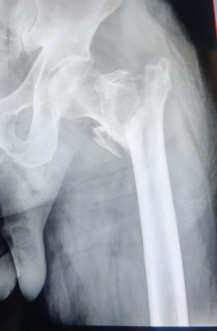 Before surgery example