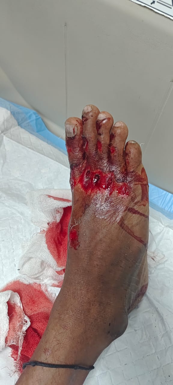 Patient recovery process image 1