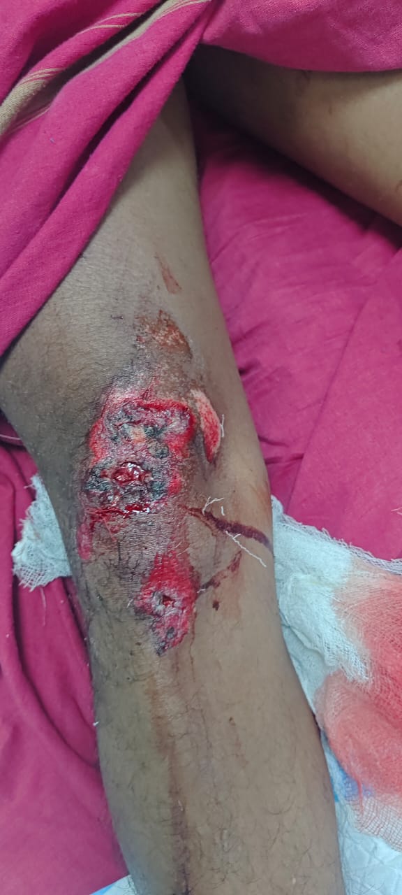 Patient recovery process image 2