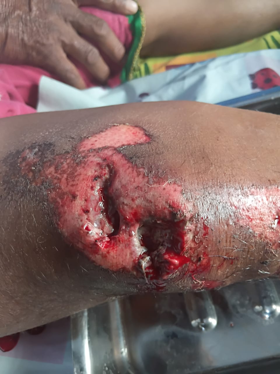 Patient recovery process image 3