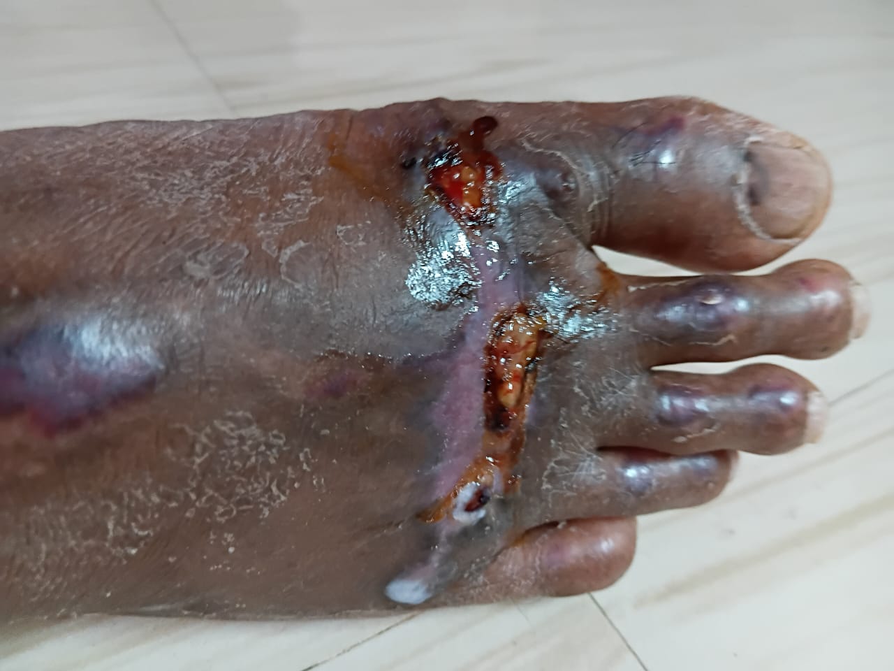 Patient recovery process image 4