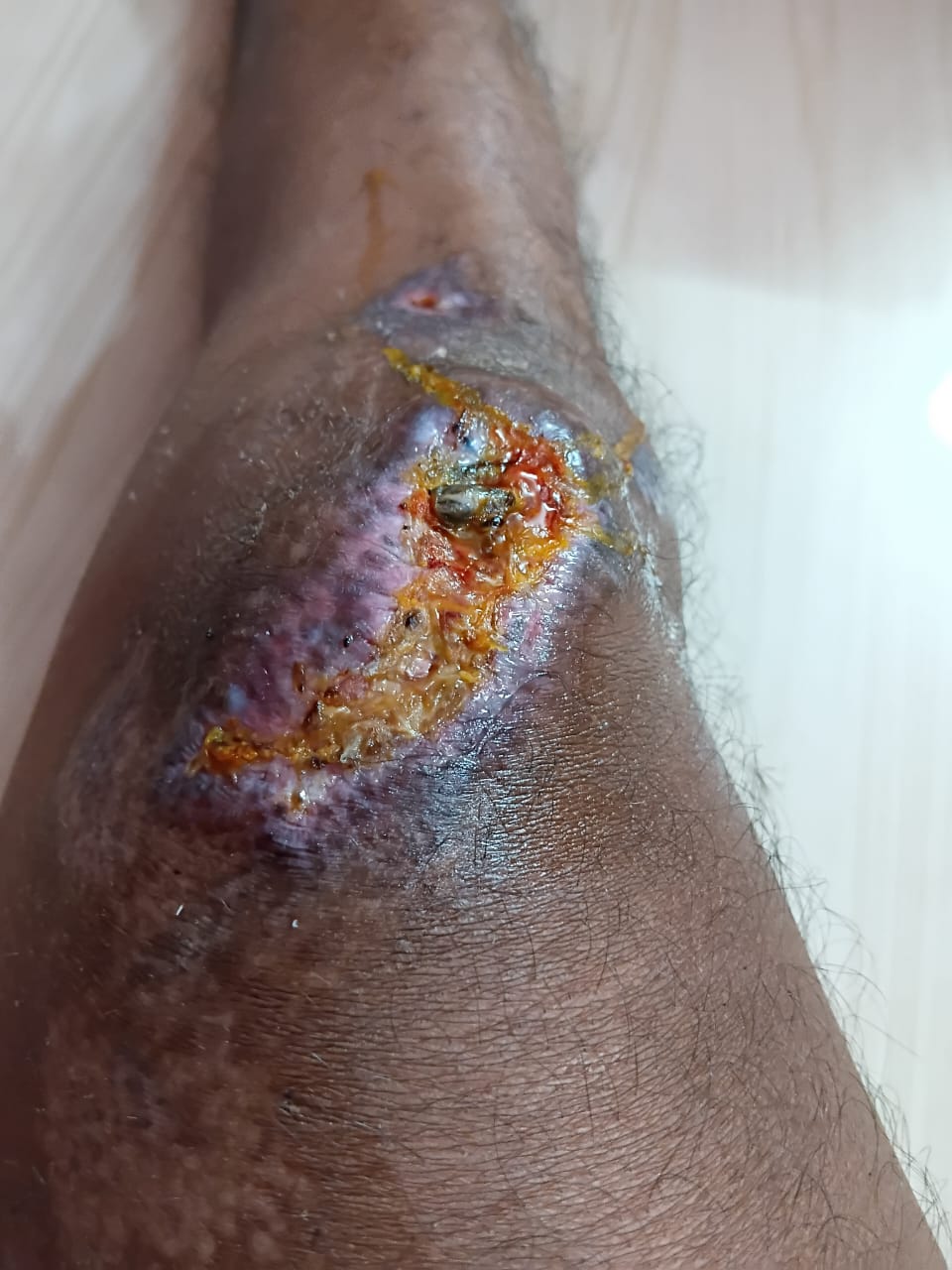 Patient recovery process image 5