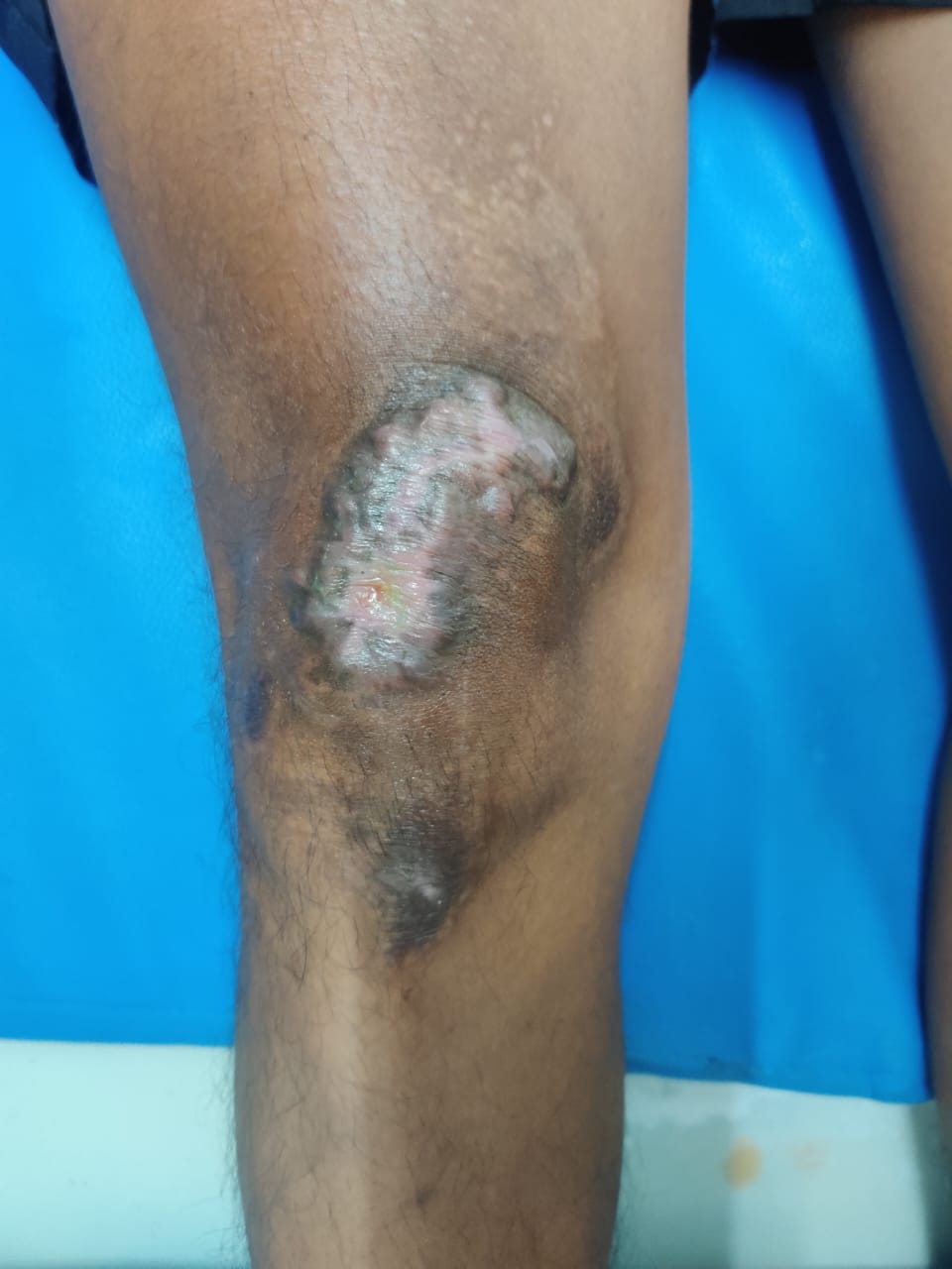 Patient recovery process image 6