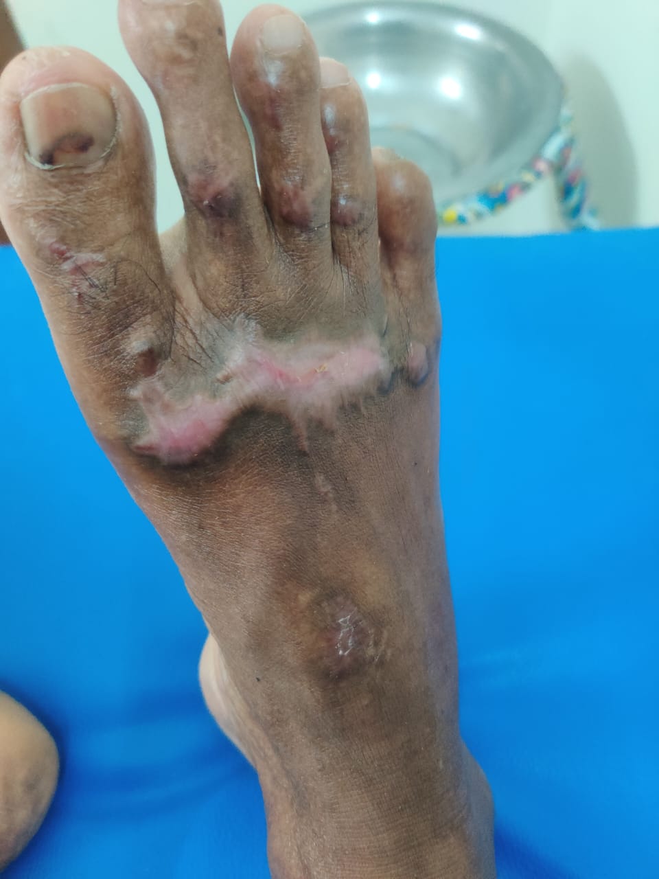 Patient recovery process image 6